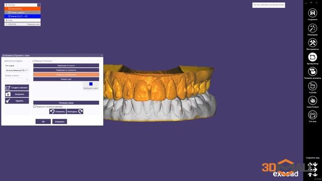 Exocad Virtual articulator Виртуальный артикулятор