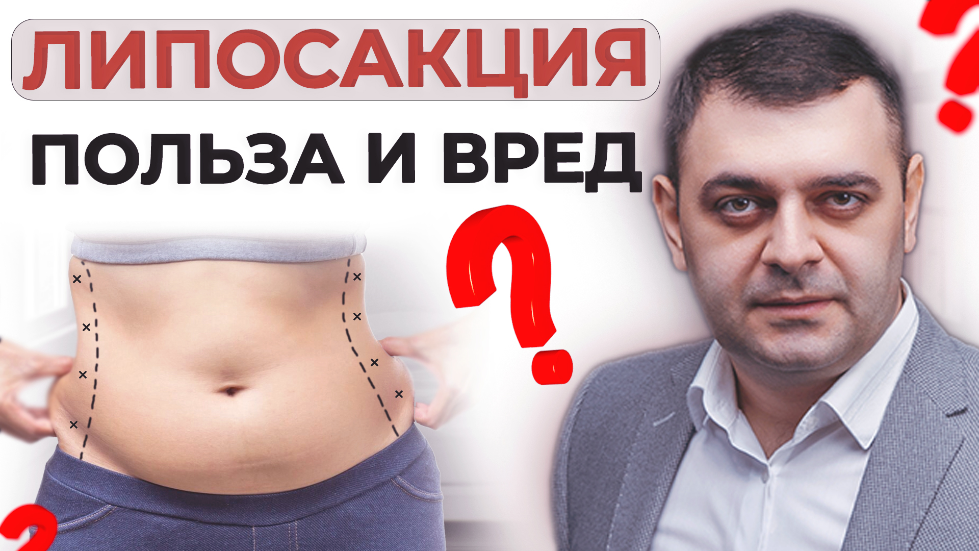 Липосакция: как проводится и противопоказания | Эффективный способ избавления от жира