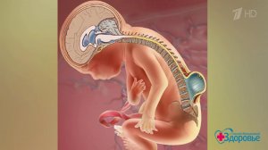 Спинномозговая грыжа. Новый метод лечения. Здоровье. Фрагмент выпуска от 27.05.2018