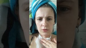 Трахеостомия.