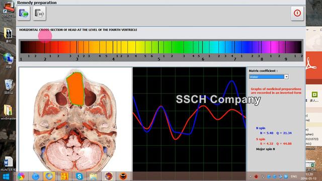 Hunter 10 Metazode смотреть онлайн