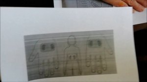 #2 ПДД: Поможем Друг Другу: Су Джок! Кашель и одышка!