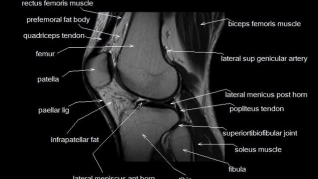 Foot Ankle & Knee MRI смотреть онлайн