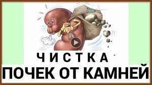 ЧИСТКА ПОЧЕК ОТ КАМНЕЙ НАРОДНЫМИ СРЕДСТВАМИ.mp4