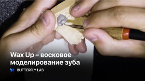 Wax Up Live. Восковое моделирование зуба. Зубной техник