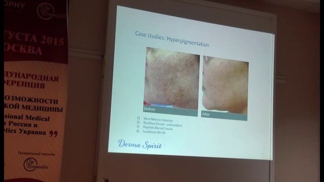 Презентация новой линии химических пилингов. Современные технологии США смотреть онлайн