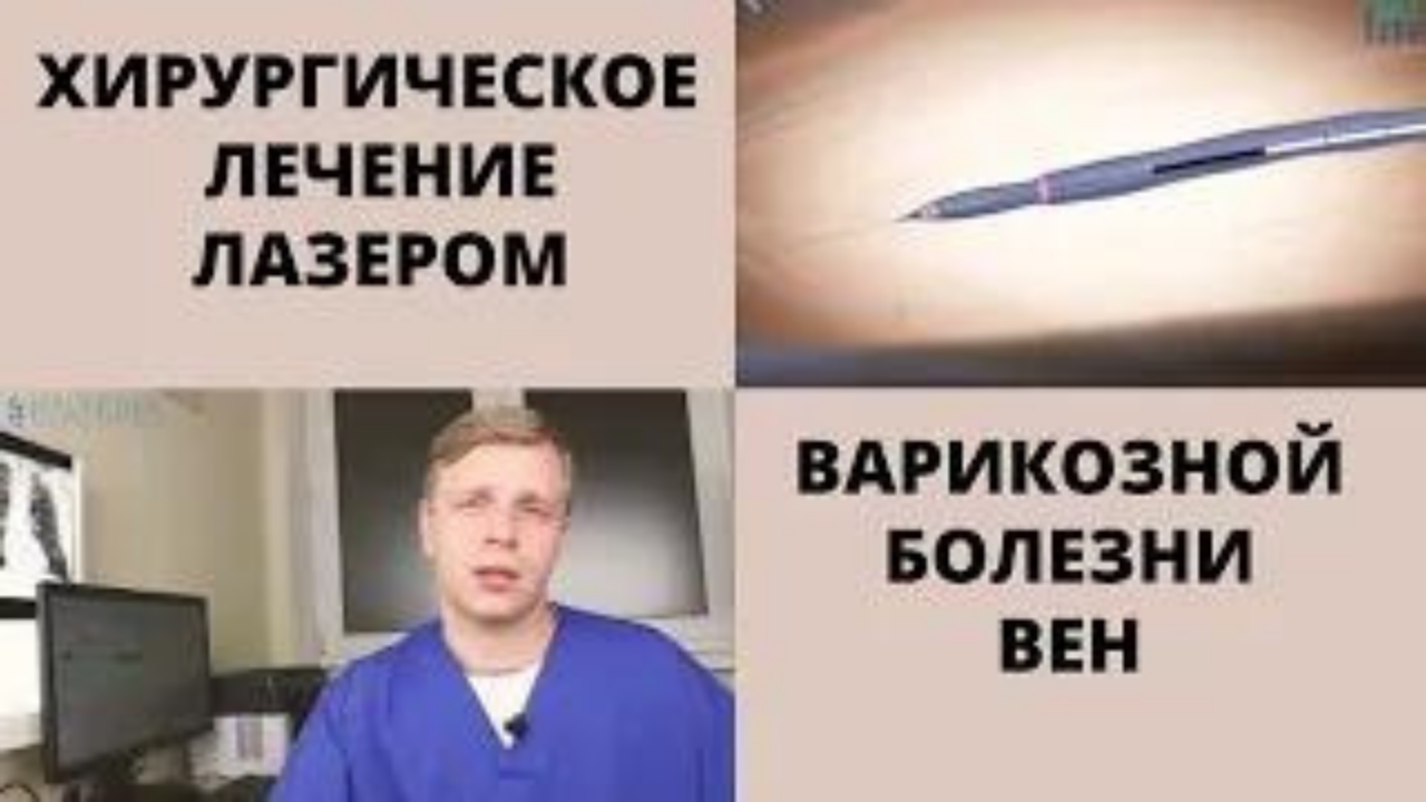 #хирургическое лечение лазером варикозной болезни вен.mp4