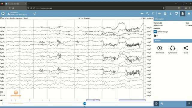 NeuroCenter EEG - Working with Online Cloud Storage смотреть онлайн