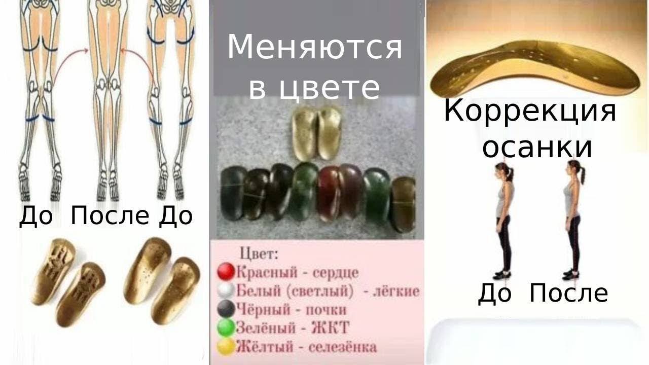 Коррекционные стельки Гучжэнцзи. Корректирующие ортопедические стельки на магнитах