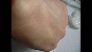 Сам себе доктор (Удаление гигромы 18+) / Be Your Own Doctor (removal hygroma 18+)