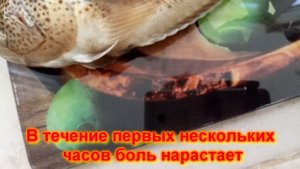 Эту рыбу боятся все! Морской дракон ядовитая рыба рыбалка в Турции подводная охота