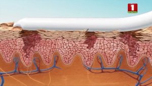 Крем для рук! Уход за руками в домашних условиях! Почему трескается кожа на пальцах рук?
