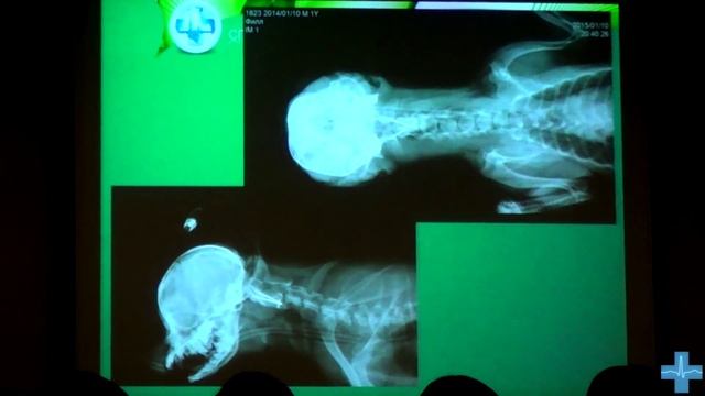 Дорсальная реконструкция впадины dewey. Клинический случай смотреть онлайн