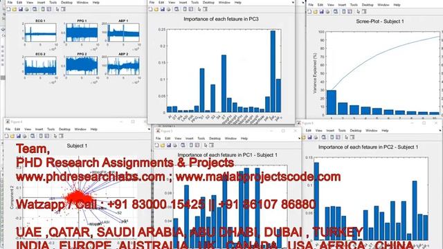 PPG || Photoplethysmography || Deep learning || Matlab Code || PPG signal Analysis