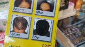 চুলের যত্নে ১০০% কাযকারি শ্যাম্পু ||Shampoo price