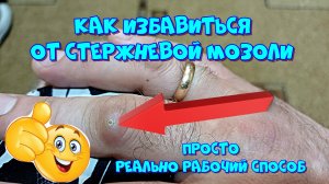 Как избавиться от стержневой мозоли. Простой и реально рабочий способ 👍