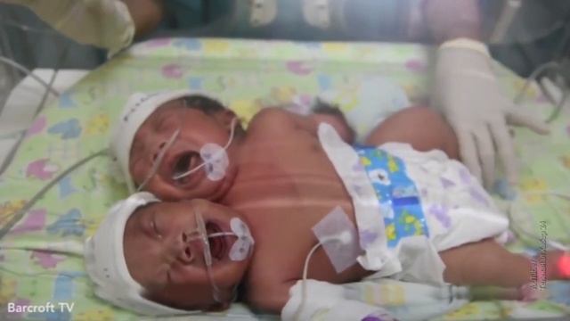 ШОК!! Сиамские близнецы Самарканда смотреть онлайн