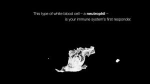 See White Blood Cells Move in 3-D Imaging