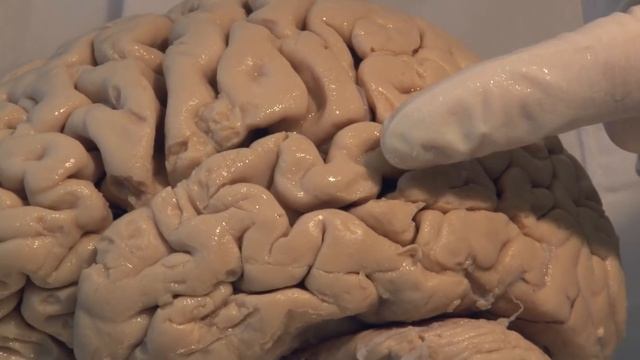 Introduction: Neuroanatomy Video Lab - Brain Dissections