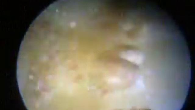 Whelk (busycon ) egg strand is dissected and put under microscope смотреть онлайн