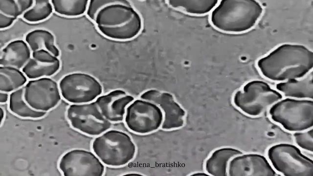 Так выглядит кровь человека, который пьет мало ВОДЫ!!! смотреть онлайн