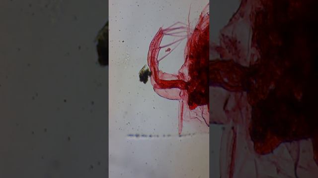 Дафния под микроскопом. (Вид ракообразных) смотреть онлайн