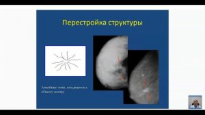 Рентгенологическое исследование молочных желез.mp4