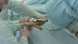 Внутрикостный остеосинтез лонных костей таза NsN