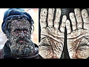 Этот Мужчина Не Мылся 60 Лет / Люди с Шокирующими Пристрастиями