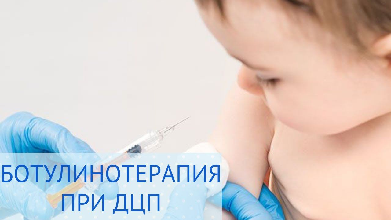 Ботулинотерапия при ДЦП