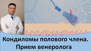 Кондиломы на половом члене. Прием дерматовенеролога