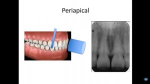 Как читать стоматологические рентгеновские снимки |How to Read Dental X-Rays