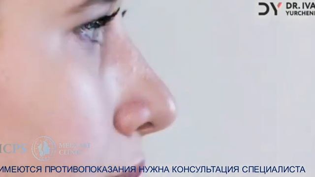 Видео отзыв о работе пластического хирурга Юрченко Ивана Анатольевича смотреть онлайн
