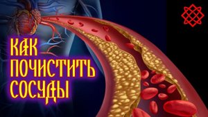 KAК ПOЧИCТИТЬ COCУДЫ БЫCТPO И ЭФФEКТИВНO. Чистим Сосуды Правильно.mp4
