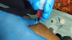 внутримышечная инъекция