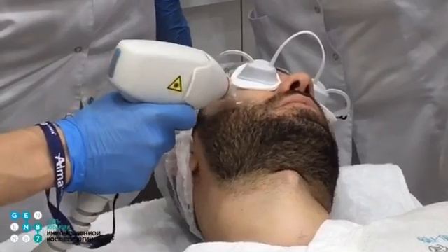 Лазерная эпиляция Soprano ICE Platinum смотреть онлайн