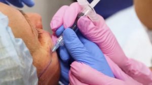 Увеличение скул и увеличение губ филлером с гиалуроновой кислотой Repleri