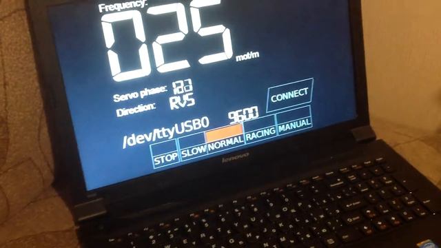 Balloon-Tech: Donders Lung Model смотреть онлайн