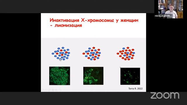 Синдром Альпорта - лекция для пациентов и их родителей