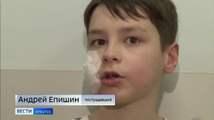 Прокуратура Иркутска начала проверку по факту нападения собаки на детей в предместье Радищева
