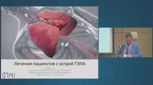 Лечение пациентов с ТЭЛА. Гиляров М.Ю.