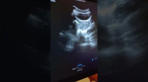 Практическое занятие 1. Методика трансабдоминального УЗИ матки и придатков (Паленый А.И.).