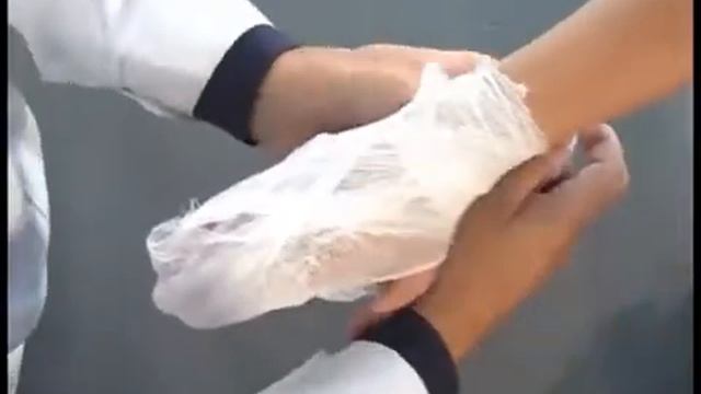 Наложение повязки при повреждении кисти смотреть онлайн