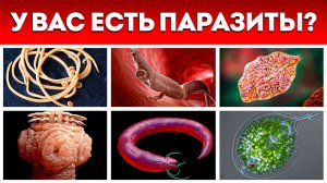 Опасные ПАРАЗИТЫ в человеке: НЕ ДАЙ СЕБЯ УБИТЬ! / Самое популярное средство от глистов