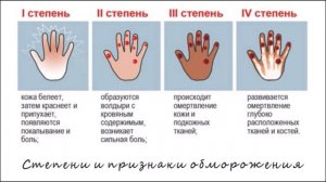 Первая помощь при обморожении