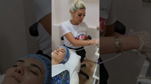 Механическая чистка лица