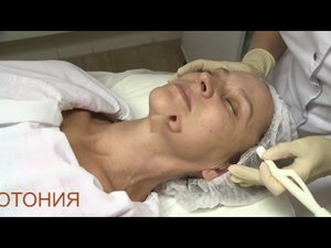 Дермотония
