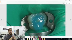 ВКЛАДКА ИЛИ ШТИФТ? КАК ВОССТАНАВЛИВАТЬ ЗУБ?