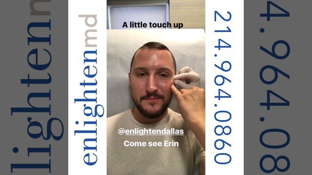 BRO-TOX | Botox for Men | Enlighten MD смотреть онлайн