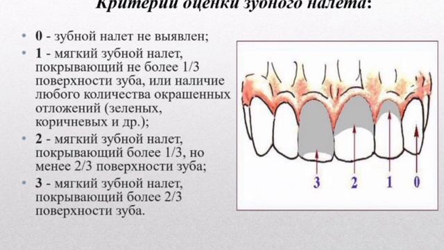 Оценка пародонта. Индекс гигиены Грина Вермиллиона для зубного налета. Методика выявления зубных отложений. Индекс гигиены по Грину Вермиллиону. Методы выявления зубного налета.